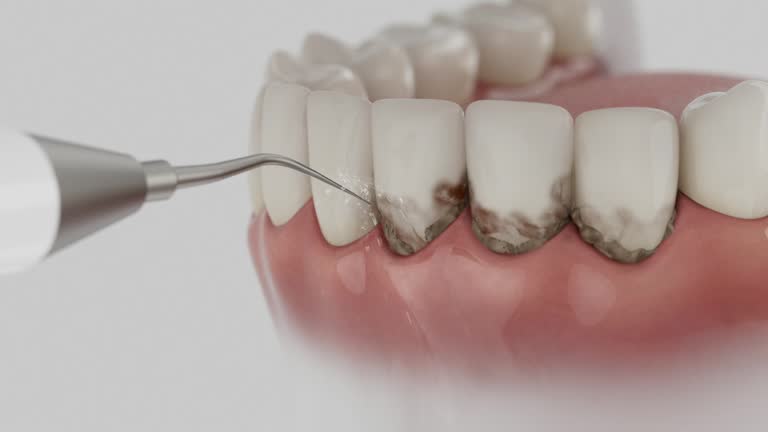 Reliable Tooth Extraction contractor in Oak Park, CA by Smile Center Dentistry